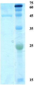 Toxoplasma gondii surface antigen (SAG) 2 (capture)  