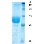 Toxoplasma gondii surface antigen (SAG) 2 (detection)