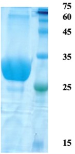 Toxoplasma gondii surface antigen (SAG) 2 (detection)