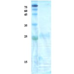 Toxoplasma gondii surface antigen (SAG) 2