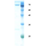 Salmonella H antigen protein