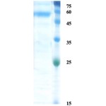 Zika NS1 protein (insect cell)