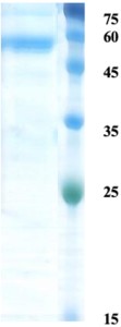 Zika NS1 protein (insect cell) Zika NS1 protein (insect cell)