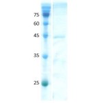 Human Anti-Mullerian Hormone (AMH) C-terminal