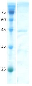 Human Anti-Mullerian Hormone (AMH) C-terminal