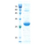 Human Anti-Mullerian Hormone (AMH) C-terminal