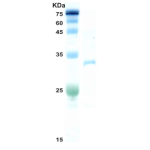 HIV-1 gag p24 protein (insect cell)