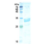 Trypanosoma cruzi chimeric chagas protein (detection)