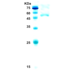 HIV-1 type O envelope gp120/gp41 protein 