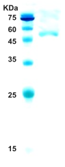 HIV-1 type O envelope gp120/gp41 protein 