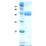 Helicobactor pylori (H. pylori) CagA protein (detection)