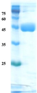 Helicobactor pylori (H. pylori) CagA protein (detection)