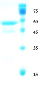 Helicobactor pylori (H. pylori) UreA protein Helicobactor pylori (H. pylori) UreA protein