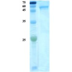 Plasmodium knowlesi lactate dehydrogenase (Pk-LDH) protein