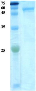 Plasmodium knowlesi lactate dehydrogenase (Pk-LDH) protein