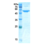 Covid-19 nucleocapsid protein