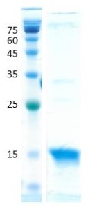 Interleukin 4 (IL-4)