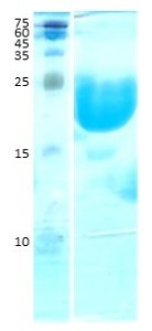 Interleukin 1b (IL-1b)