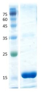 Interleukin 5 (IL-5) Interleukin 5 (IL-5)
