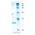 Tumor Necrosis Factor a