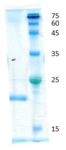 Tumor Necrosis Factor a