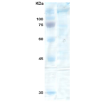 Covid-19 whole spike protein trimer (insect cell)