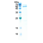 Covid-19 nucleocapsid protein (insect cell)