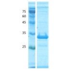 Deamidated gliadin peptide antigen 