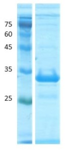 Deamidated gliadin peptide antigen Deamidated gliadin peptide antigen