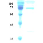 Treponema pallidum (Syphilis) p15/p17/p47 fusion protein