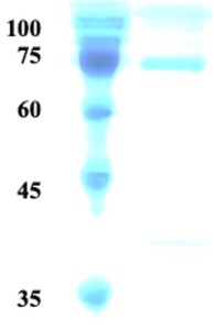 Treponema pallidum (Syphilis) p15/p17/p47 fusion protein