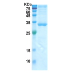 Covid-19 S-RBD + Subdomain 1 (insect cell)