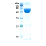 Covid-19 nucleocapsid protein (Omicron, B.1.1.529)