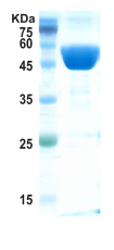 Covid-19 nucleocapsid protein (Omicron, B.1.1.529)