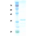 Rubella virus E1 protein