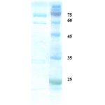 Rubella virus E2 protein