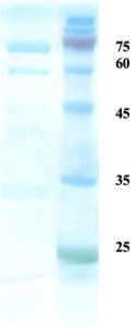 Rubella virus E2 protein