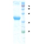 Rubella virus E1-E2 protein 