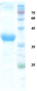 Rubella virus E1-E2 protein 