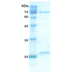 HIV-2 gag p26 protein