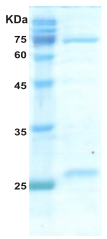 HIV-2 gag p26 protein
