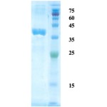 Helicobacter pylori (H. pylori) CagA protein (capture)