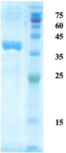 Helicobacter pylori (H. pylori) CagA protein (capture) Helicobacter pylori (H. pylori) CagA protein (capture)