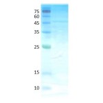 Dermatophagoides pteronyssinus (der p 1)