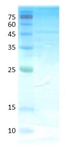 Dermatophagoides pteronyssinus (der p 1)