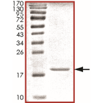 Beta-synuclein Protein
