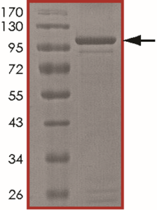 STAT1 beta Protein
