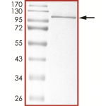 STAT3 Protein