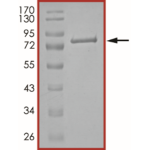 STAT4 Protein