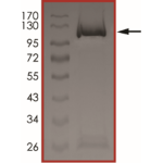 STAT5B Protein